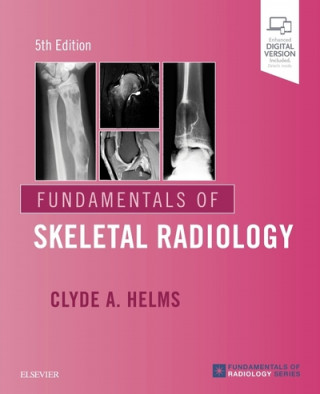 Kniha Fundamentals of Skeletal Radiology Clyde Helms
