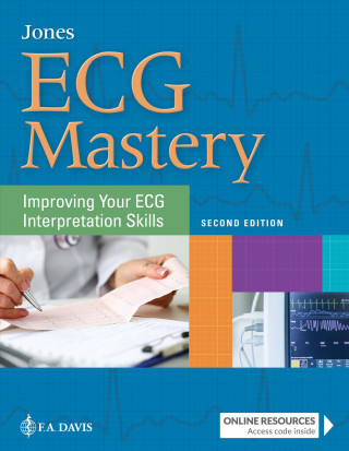 Carte ECG Mastery Shirley A. Jones