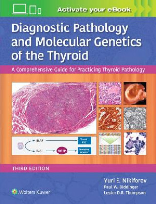 Kniha Diagnostic Pathology and Molecular Genetics of the Thyroid Yuri E. Nikiforov