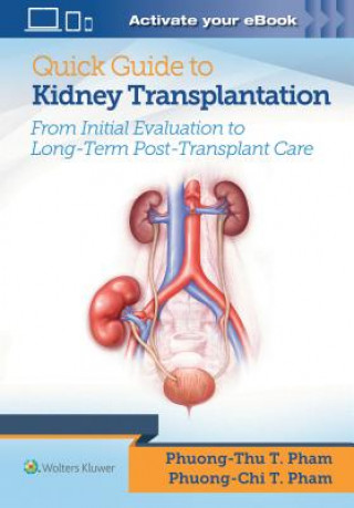 Książka Quick Guide to Kidney Transplantation Phuong-Chi T. Pham