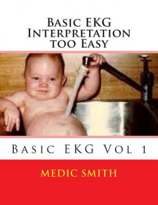 Knjiga Basic EKG Interpretation Too Easy Medic Smith