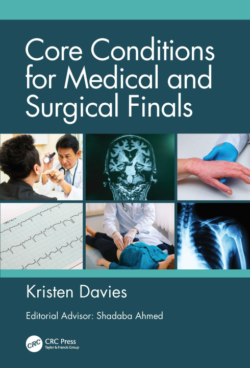 Kniha Core Conditions for Medical and Surgical Finals DAVIES