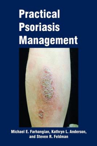 Livro Practical Psoriasis Management Michael E Farhangian