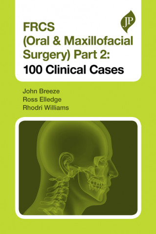 Carte FRCS (Oral & Maxillofacial Surgery) Part 2: 100 Clinical Cases John Breeze