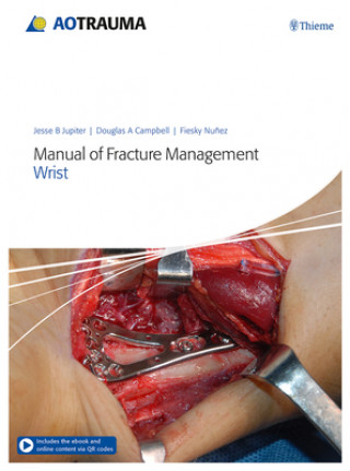 Kniha Manual of Fracture Management - Wrist Jesse B. Jupiter