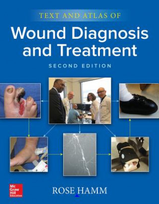 Kniha Text and Atlas of Wound Diagnosis and Treatment, Second Edition Rose Hamm