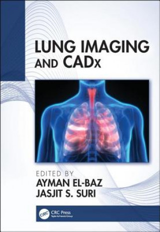 Knjiga Lung Imaging and CADx 