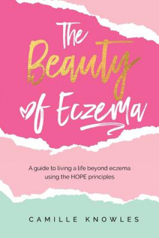 Carte The Beauty of Eczema: A Guide To Living a Life Beyond Eczema Using The Hope Principles Camille Knowles