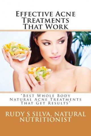 Kniha Effective Acne Treatments That Work: Best Whole Body Natural Acne Treatments That Get Results Rudy Silva Silva