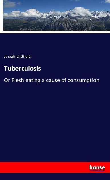 Knjiga Tuberculosis Josiah Oldfield