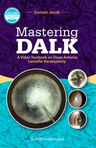Knjiga Mastering DALK Soosan Jacob