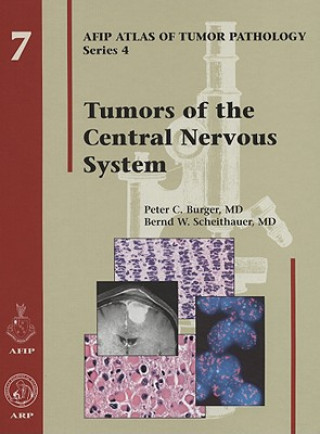 Kniha Tumors of the Central Nervous System P. C. Burger