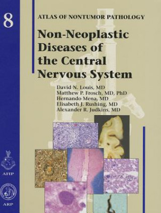 Knjiga Non-Neoplastic Diseases of the Central Nervous System David N. Louis