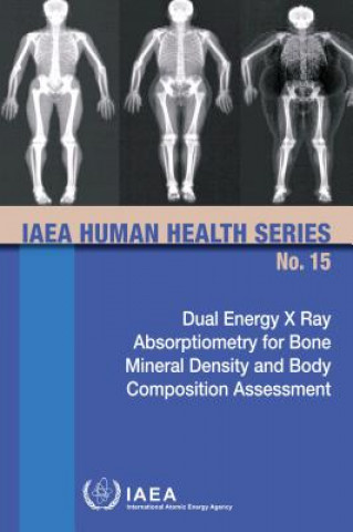 Kniha Dual Energy X Ray Absorptiometry for Bone Mineral Density and Body Composition Assessment 