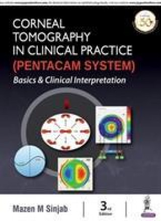 Kniha Corneal Tomography in Clinical Practice (Pentacam System) Mazen M Sinjab