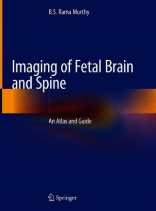Książka Imaging of Fetal Brain and Spine B. S. Rama Murthy