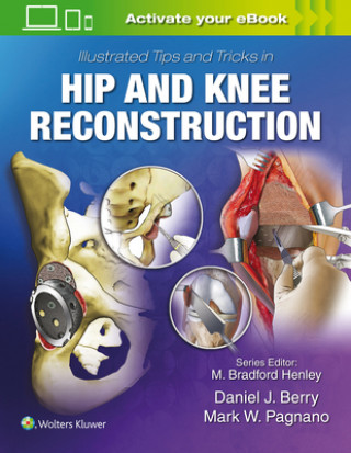 Könyv Illustrated Tips and Tricks in Hip and Knee Reconstructive and Replacement Surgery Daniel J. Berry