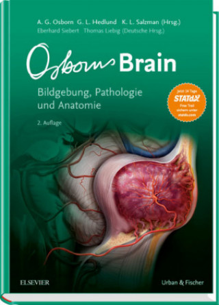 Kniha Osborn's Brain Anne G. Osborn