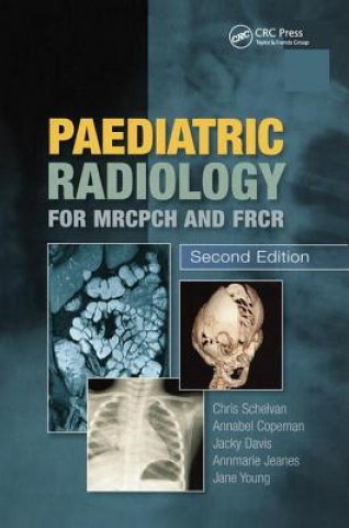 Kniha Paediatric Radiology for MRCPCH and FRCR 