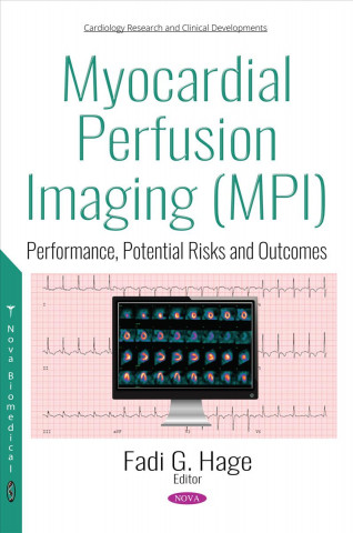 Könyv Myocardial Perfusion Imaging (MPI) 