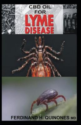 Kniha CBD Oil for Lyme Disease: All You Need to Know about Using CBD Oil to Treat Lyme Disease Ferdinand H Quinones M D