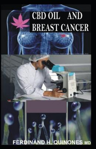 Kniha CBD Oil and Breast Cancer: Ultimate Guide on Using CBD Oil to Treat Breast Cancer Ferdinand H Quinones M D