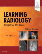 Книга Learning Radiology William Herring