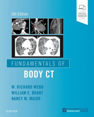 Carte Fundamentals of Body CT W. Richard Webb