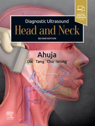Könyv Diagnostic Ultrasound: Head and Neck Anil Ahuja