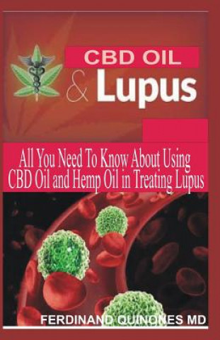 Книга CBD Oil & Lupus: All You Need to Know about Using CBD Oil and Hemp Oil in Treating Lupus Ferdinand Quinones M D