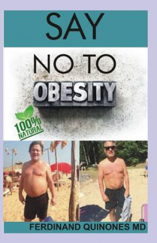 Kniha Say No to Obesity: All You Need to Know about Overcoming Obesity Ferdinand Quinones M D