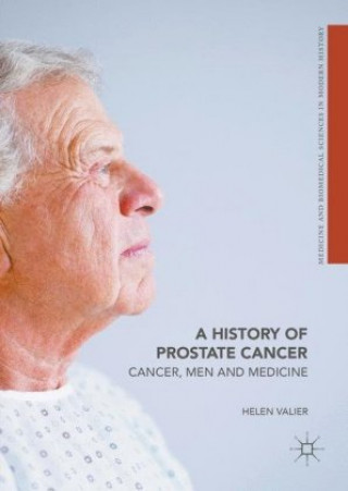 Carte History of Prostate Cancer Helen Valier