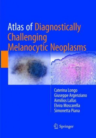 Kniha Atlas of Diagnostically Challenging Melanocytic Neoplasms Caterina Longo