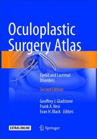 Książka Oculoplastic Surgery Atlas Geoffrey J. Gladstone