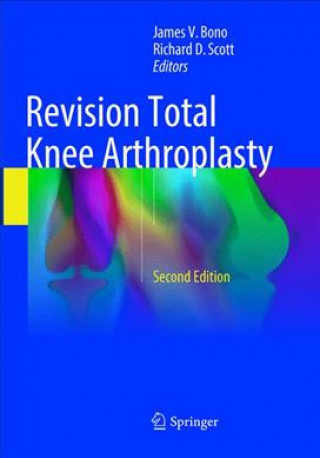 Kniha Revision Total Knee Arthroplasty James V. Bono