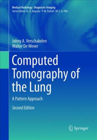 Kniha Computed Tomography of the Lung Johny A. Verschakelen