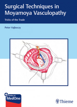 Knjiga Surgical Techniques in Moyamoya Vasculopathy Peter Vajkoczy