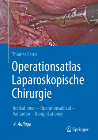 Книга Operationsatlas Laparoskopische Chirurgie Thomas Carus