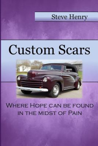 Könyv Custom Scars: Where Hope Can Be Found in the Midst of Pain April Williams