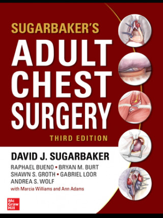 Kniha Sugarbaker's Adult Chest Surgery David J. Sugarbaker