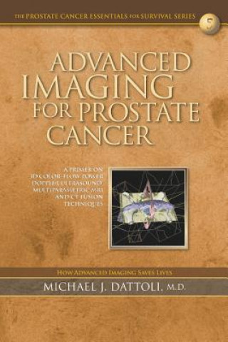 Kniha Advanced Imaging for Prostate Cancer: A Primer on 3D Color-Flow Power Doppler Ultrasound, Multiparametric MRI and CT Fusion Techniques Michael J Dattoli M D