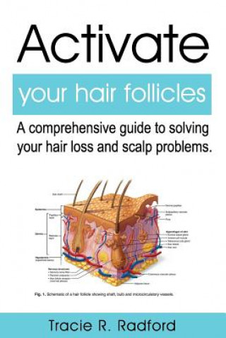 Könyv Activate Your Hair Follicles: A Comprehensive Guide to Solving Your Hair Loss and Scalp Problems Beverly Crockett