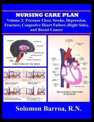 Kniha Nursing Care Plan Solomon Barroa Rn