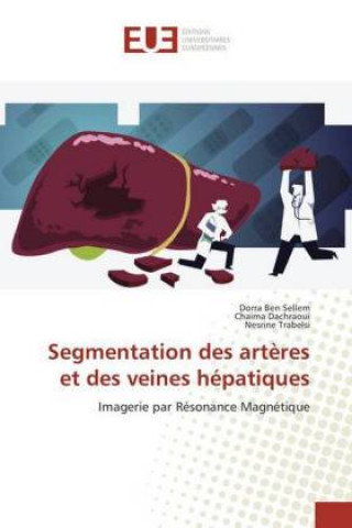 Livro Segmentation des artères et des veines hépatiques Dorra Ben Sellem