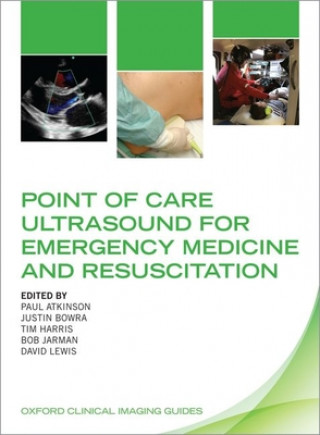 Book Point of Care Ultrasound for Emergency Medicine and Resuscitation Paul Atkinson