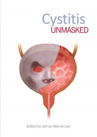 Kniha Cystitis Unmasked JAMES MALONE-LEE MD