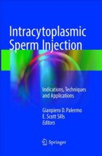 Intracytoplasmic Sperm Injection