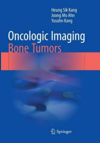 Könyv Oncologic Imaging: Bone Tumors Heung Sik Kang