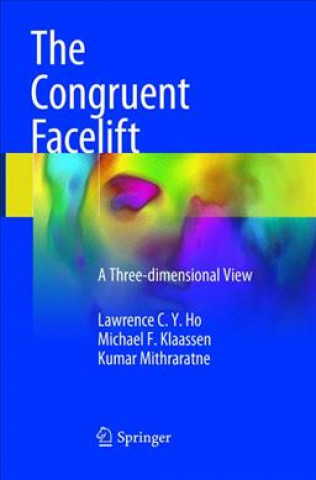 Buch Congruent Facelift Lawrence C. Y. Ho