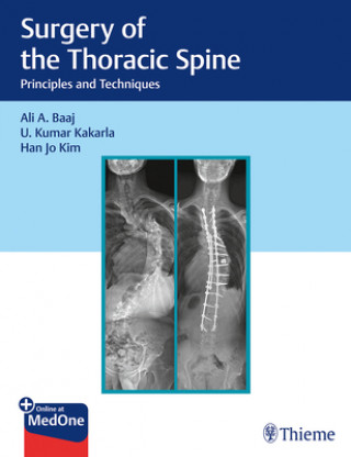 Kniha Surgery of the Thoracic Spine Ali Baaj